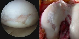 an image of the surface of the knee joint